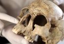 How ancient teeth are changing what we know about early drug use