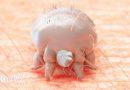 Scabies outbreak at Prince Philip hospital closes wards