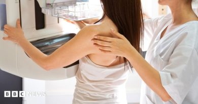 County Durham breast cancer failure bosses to review 4,500 more cases