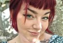 Endometriosis trial gives hope to millions of women in pain like me