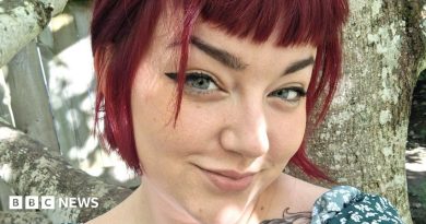 Endometriosis trial gives hope to millions of women in pain like me