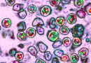 Another measles-related death reported in Pennsylvania as outbreak grows