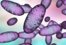 Russian lab worker dies amid plague reports — here’s what we know
