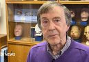 Unilateral microtia: I could never hear on my left side – until I got a prosthetic ear