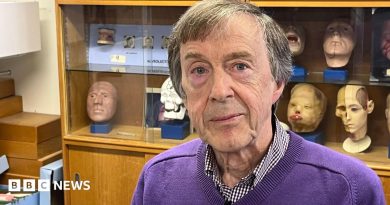 Unilateral microtia: I could never hear on my left side – until I got a prosthetic ear